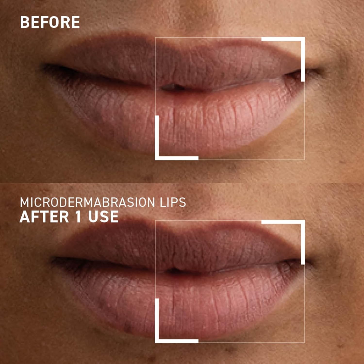 Dr. Brandt Microdermabrasion Lip Exfoliator 0.35 oz for Smooth, Renewed Lips - Image 4