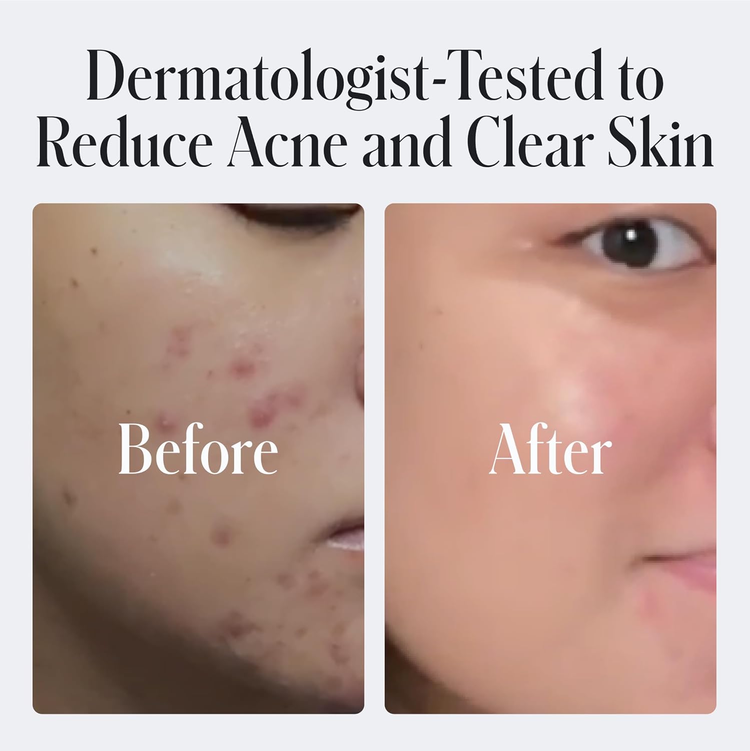 Geologie Daily Face Wash for Sensitive Skin | Fragrance-Free Facial Cleanser for Men & Women | Acne & Oil Control | Non-irritating, Gentle Cleansing & Soothing Face Wash | 2-Pack - Image 3