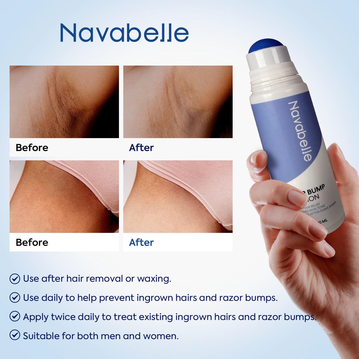 Ingrown Hair Treatment Serum for Women: Razor Bump & Burn Relief for Bikini Area, Legs, Armpits & Face – Post-Shave Post-Wax Roller with Salicylic & Glycolic Acid – Made in USA – 3.38 fl oz - Image 5
