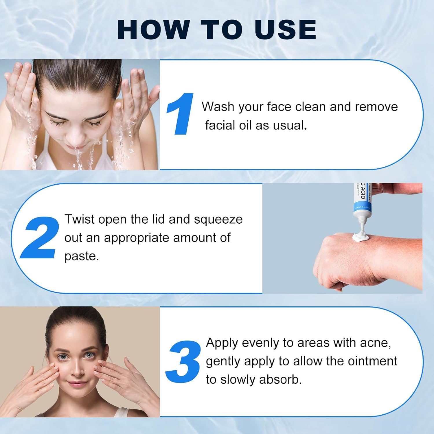 10% Azelaic Acid Cream for Face - Acne Cream for Rosacea Reducing Relief Pimple Breakouts Blackhead Pigmentation and Redness - Azelaic Acid Gel For Facial and Skin Care - Image 6