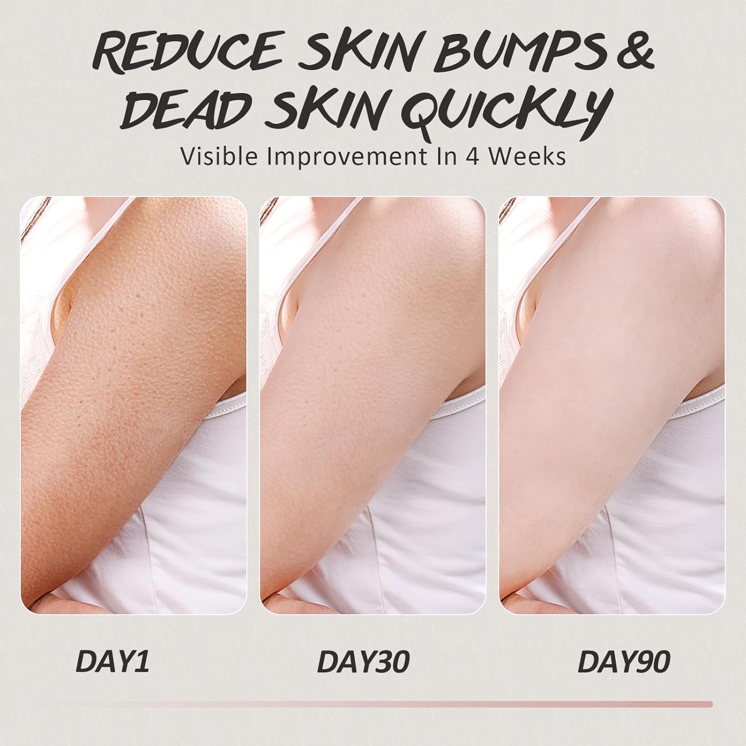 Kp Bump Eraser Body Scrub 300g for Keratosis Pilaris with Salicylic Acid and AHA - Image 5