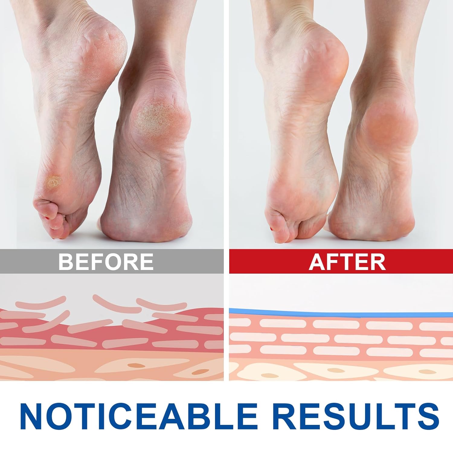 Urea Cream Stick 60% with 2% Salicylic Acid, 2.5 oz Moisturizing Lotion for Dry Feet - Image 6