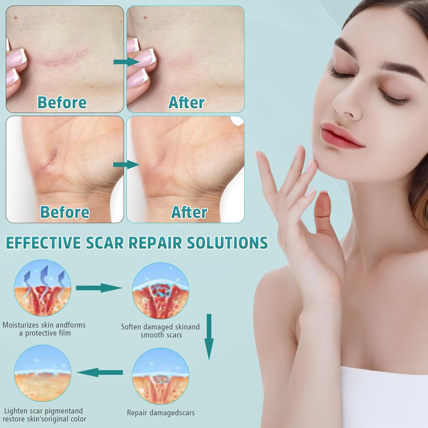 Advanced Scar Cream, Silicone Gel for Scars, Professional Scar Removal Cream for Surgical Scars, Stretch Marks, Old and New Scars 1.7 oz(50ml) - Image 5