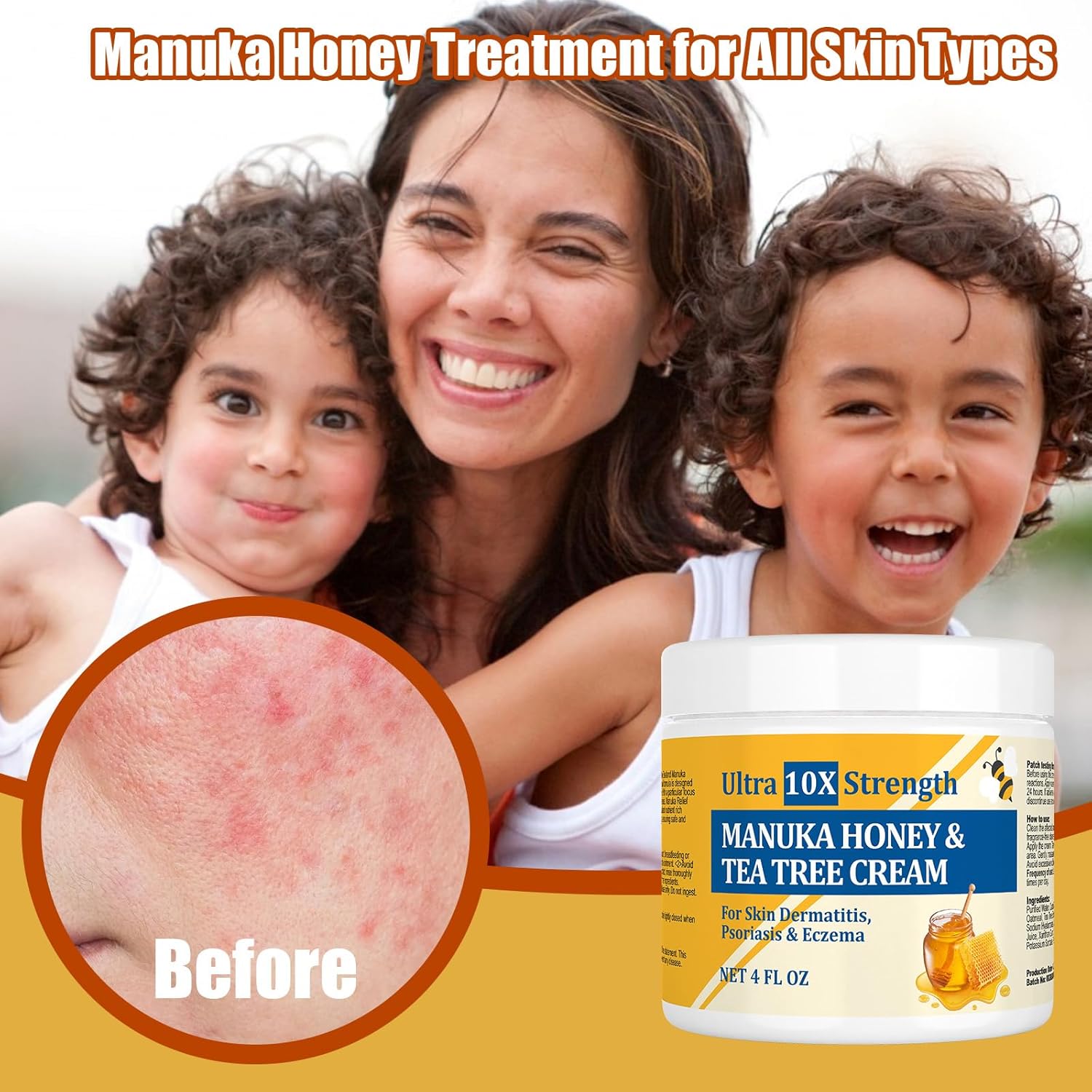 Manuka Honey Cream for Eczema, Psoriasis, and Irritated Skin 4 oz - Image 3