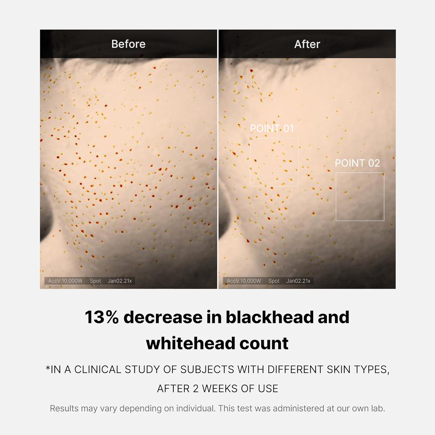 Medicube Zero Pore One-Day Serum 1.01 fl oz Overnight Resurfacing AHA BHA PHA Niacinamide - Image 5