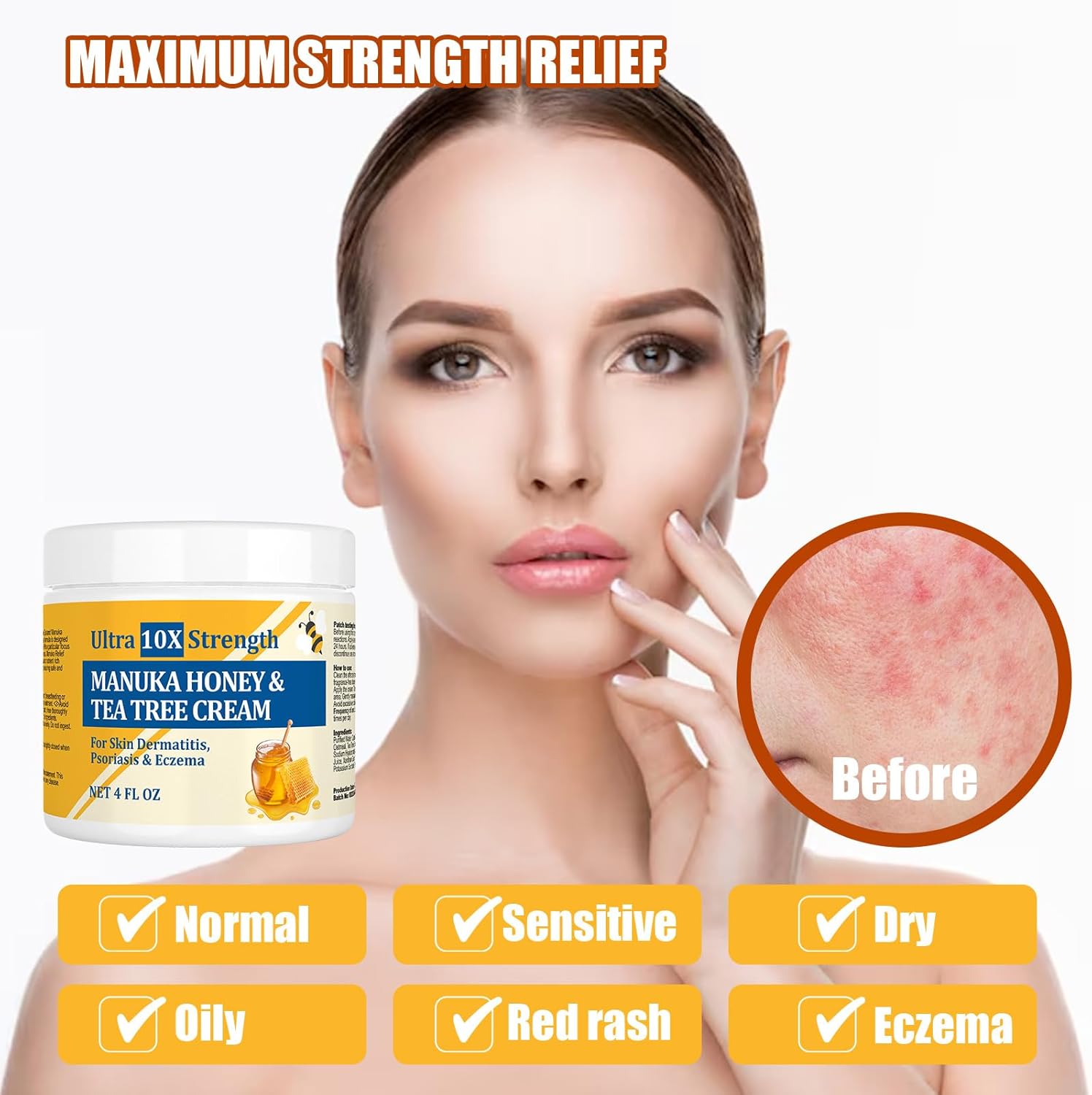 Manuka Honey Cream for Eczema, Psoriasis, and Irritated Skin 4 oz - Image 2