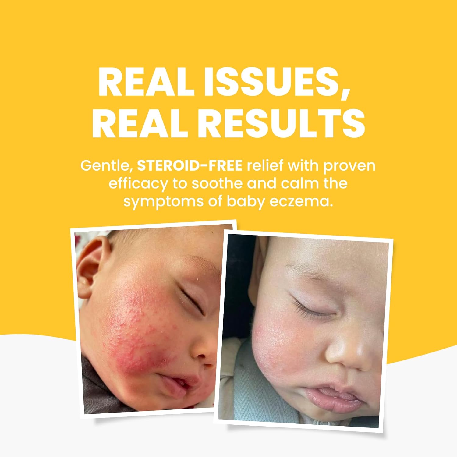 Gentle Baby Eczema Cream Moisturizer for Newborn to 12 Years, 75g, Steroid-Free - Image 3