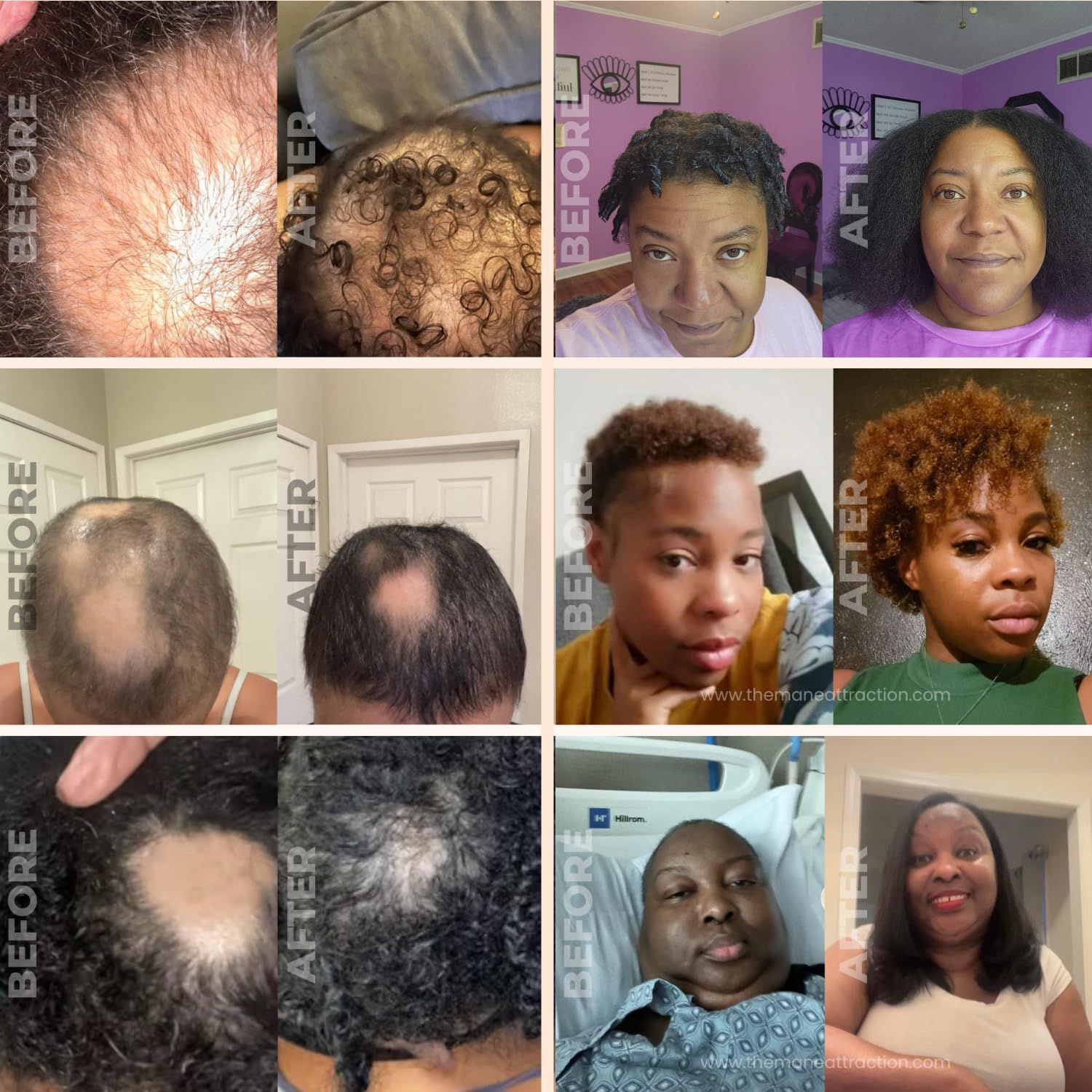 The Mane Attraction Extra Strength Rosemary + Fenugreek Herbal Hair Growth Oil | Infused With Castor Oil for ALL Hair Types - Image 4