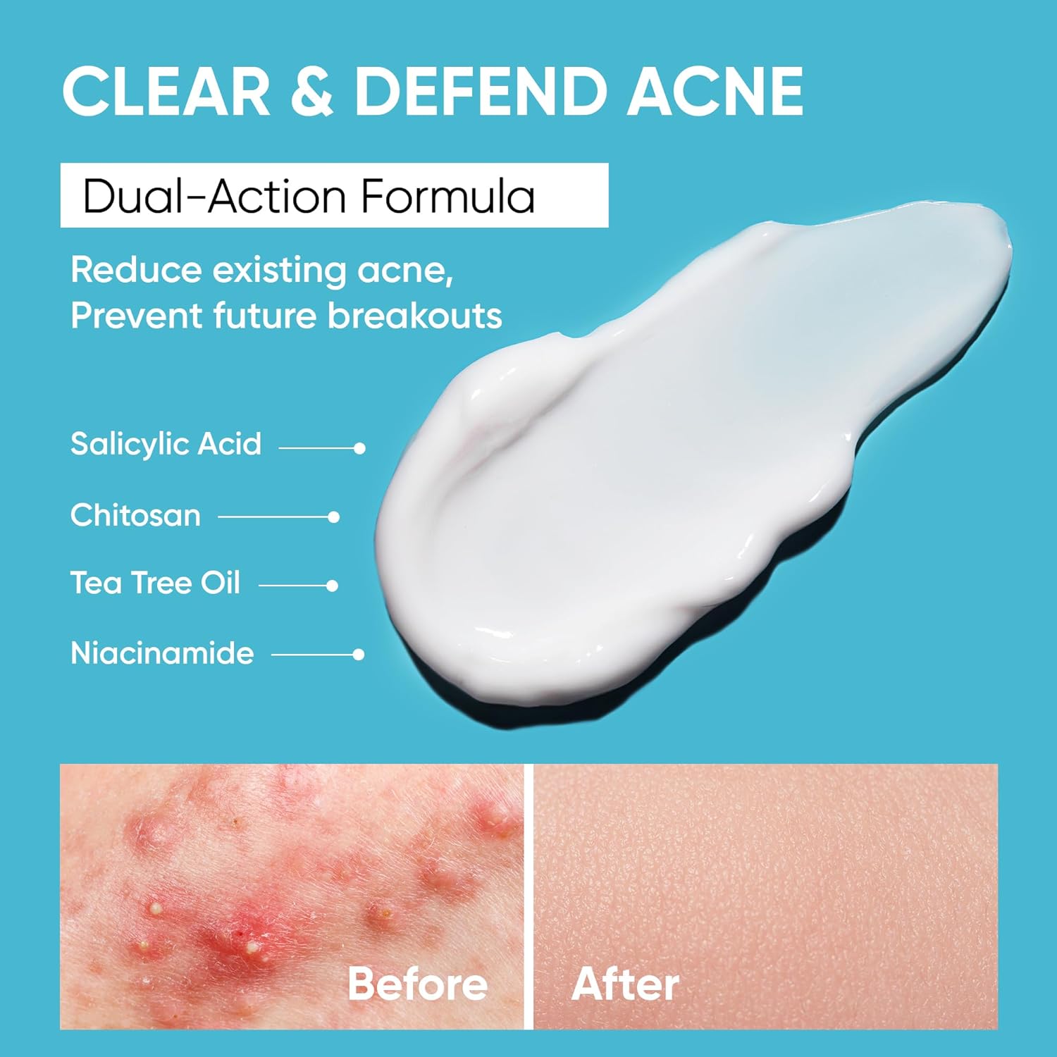 All Ages Butt Acne Clearing Treatment Cream 4 oz with Salicylic Acid Niacinamide - Image 3