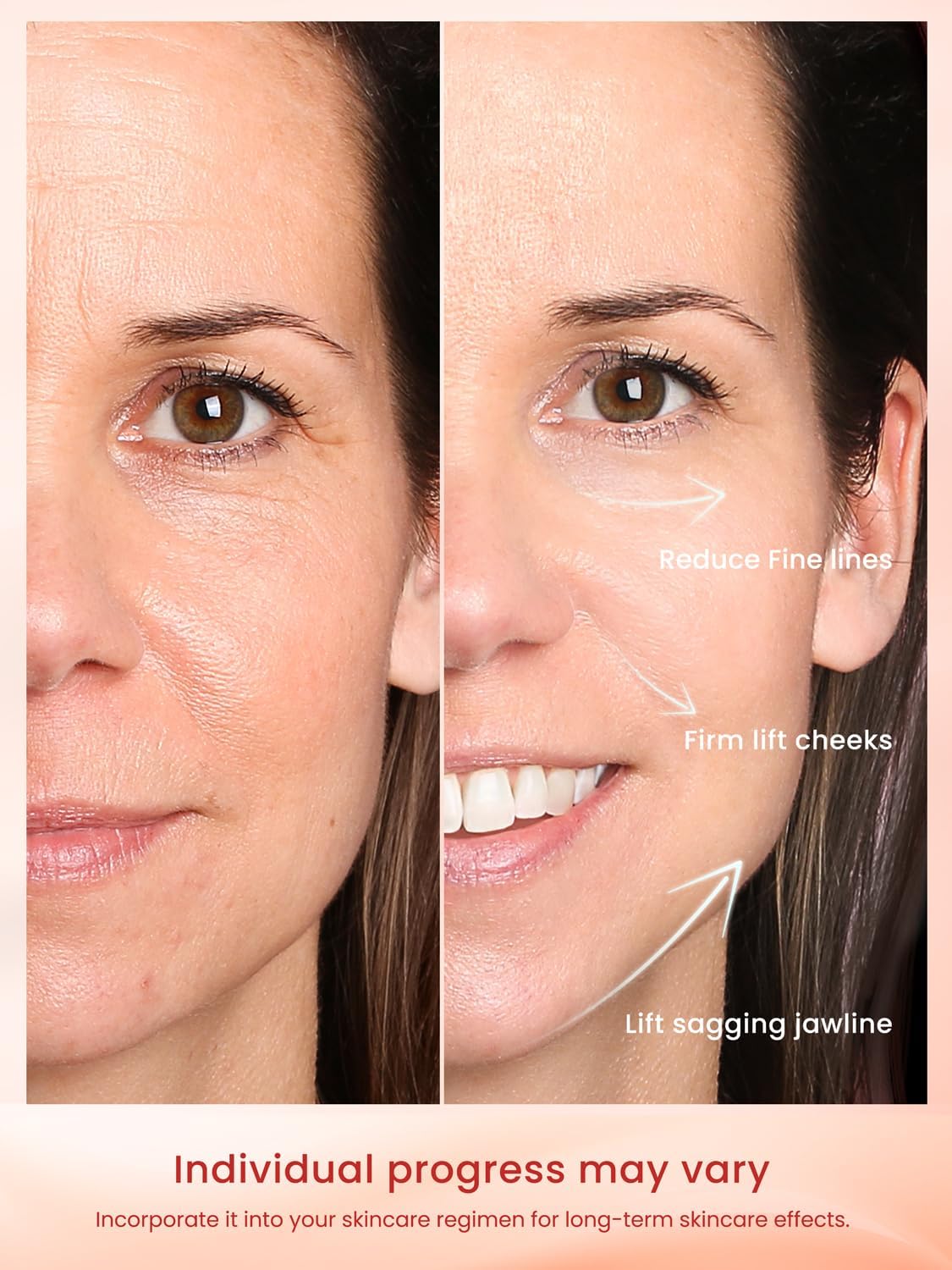Radio Frequency Skin Tightening Device, Anti-Aging Face Machine for Wrinkle Removal, Lifting & Firming, Wireless Home Beauty Device with 3 Levels, at-Home Skin Renewal - Image 4