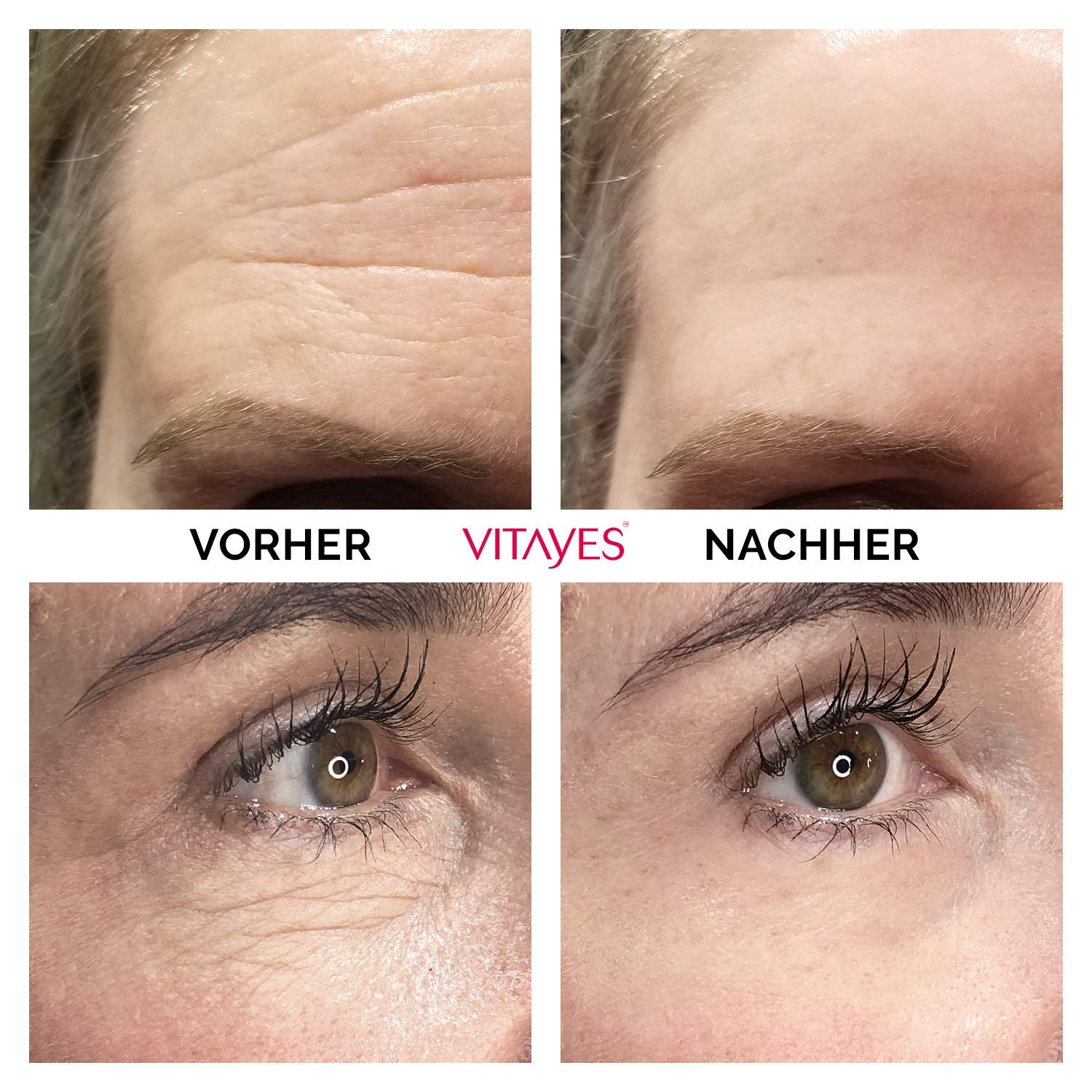 VITAYES Instant Ageback Lifting Cream 0.24 Oz for Dark Circles and Wrinkles - Image 2