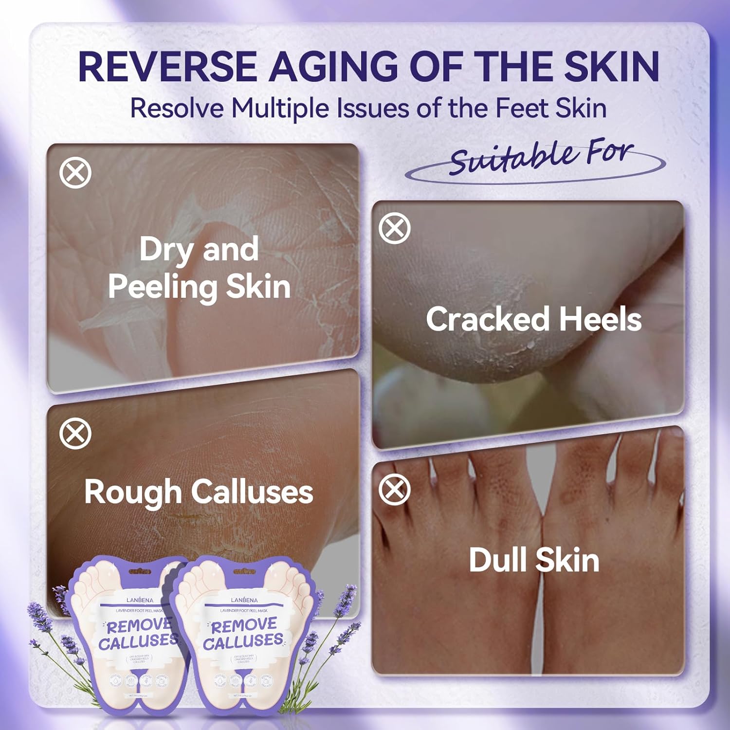 LANBENA Lavender Foot Peel Mask for Soft Feet, Removes Dead Skin and Calluses, 2 Pairs - Image 5