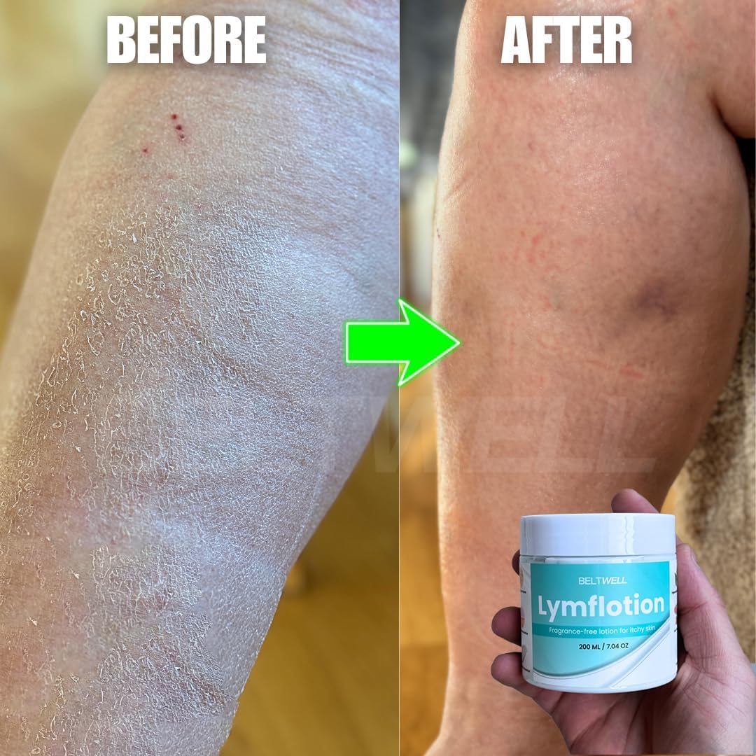 Ultra-Soft Lymphatic Lotion - Moisturizes Dry Skin, Reduces Swelling & Puffiness, Supports Healthy Circulation, Enhances Skin Health - Image 6