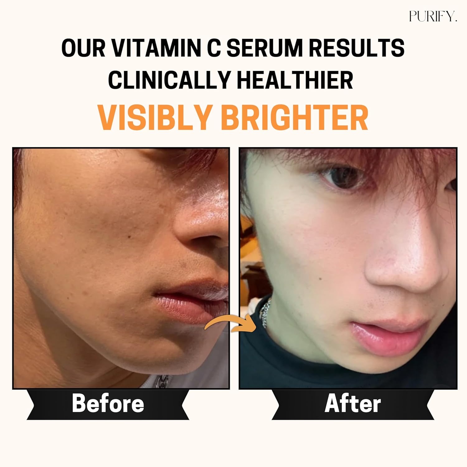 Purify 20% Vitamin C Serum - with Vitamin E & Ferulic Acid - Anti Aging - Brightening Face Serum - Pure Vit C for Dark Spots Correcting, Uneven Skin Tone, Wrinkles, Glow - 1 fl oz. - Image 5