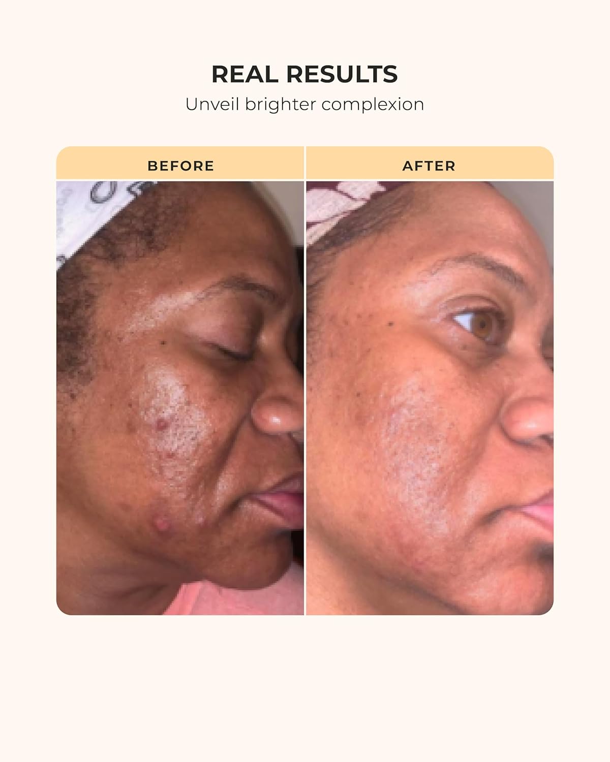 Buttah Skin by Dorion Renaud Oil-Free Hyaluronic Gel Cream 2oz - Daily Moisturizer - Hyaluronic Acid for Deep Hydration - AM & PM Moisturizer - Naturally Based Skin Care - Black-Owned Skincare - Image 6