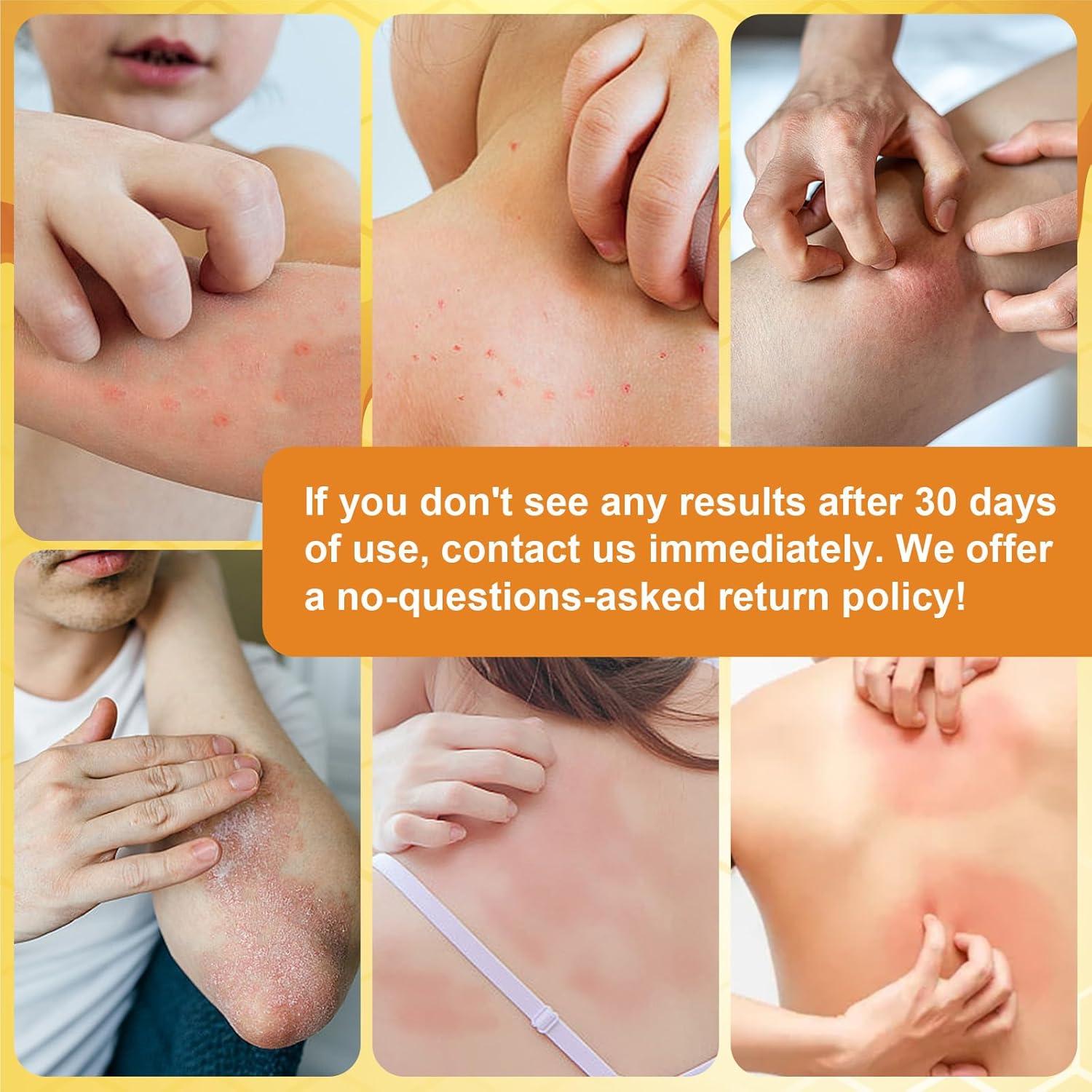Organic Manuka Honey Eczema Cream for Soothing Relief of Dry, Itchy, Irritated Skin. - Image 4