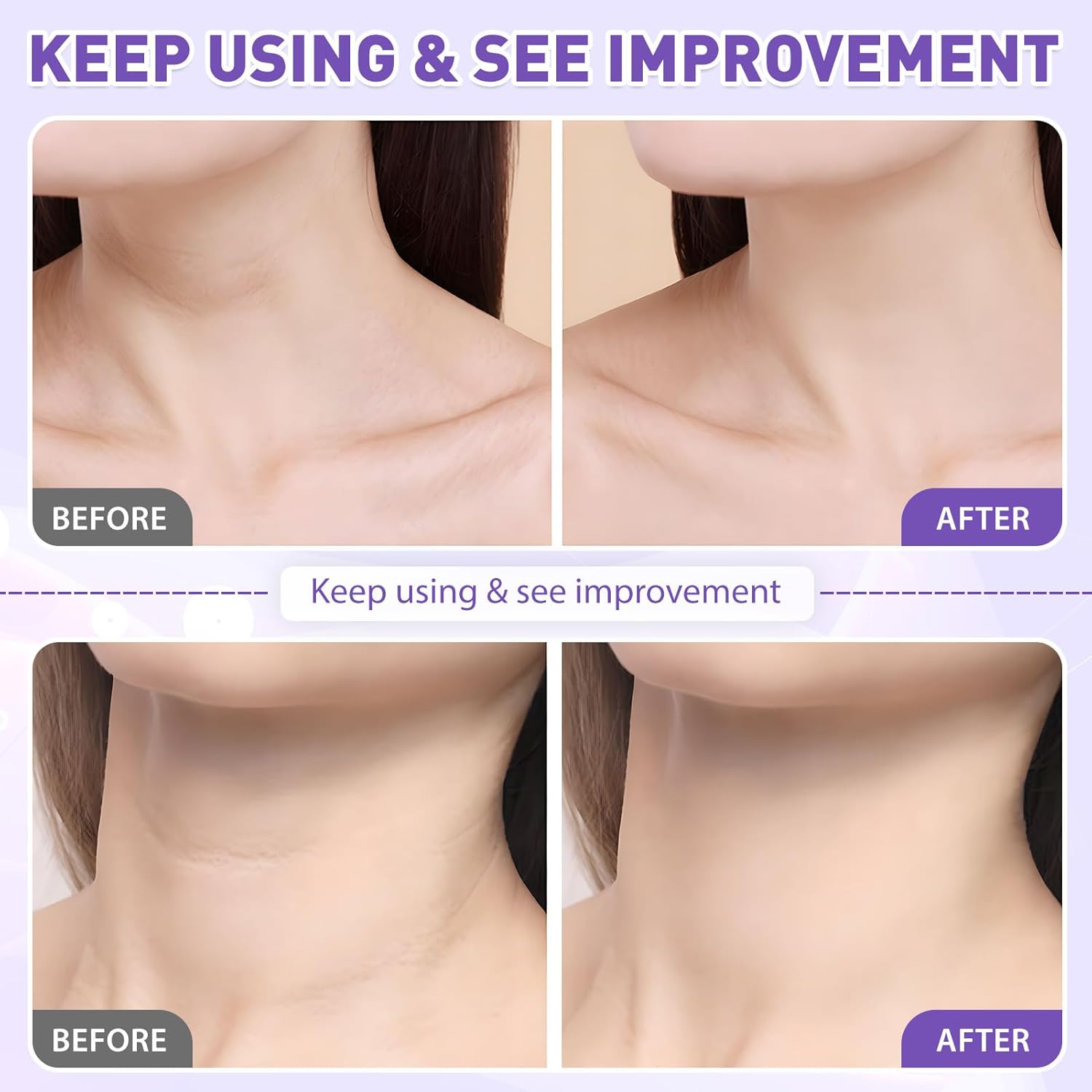 2 Pack Retinol Neck Firming Cream for Tightening and Anti-Aging, 1.7 oz Each - Image 5
