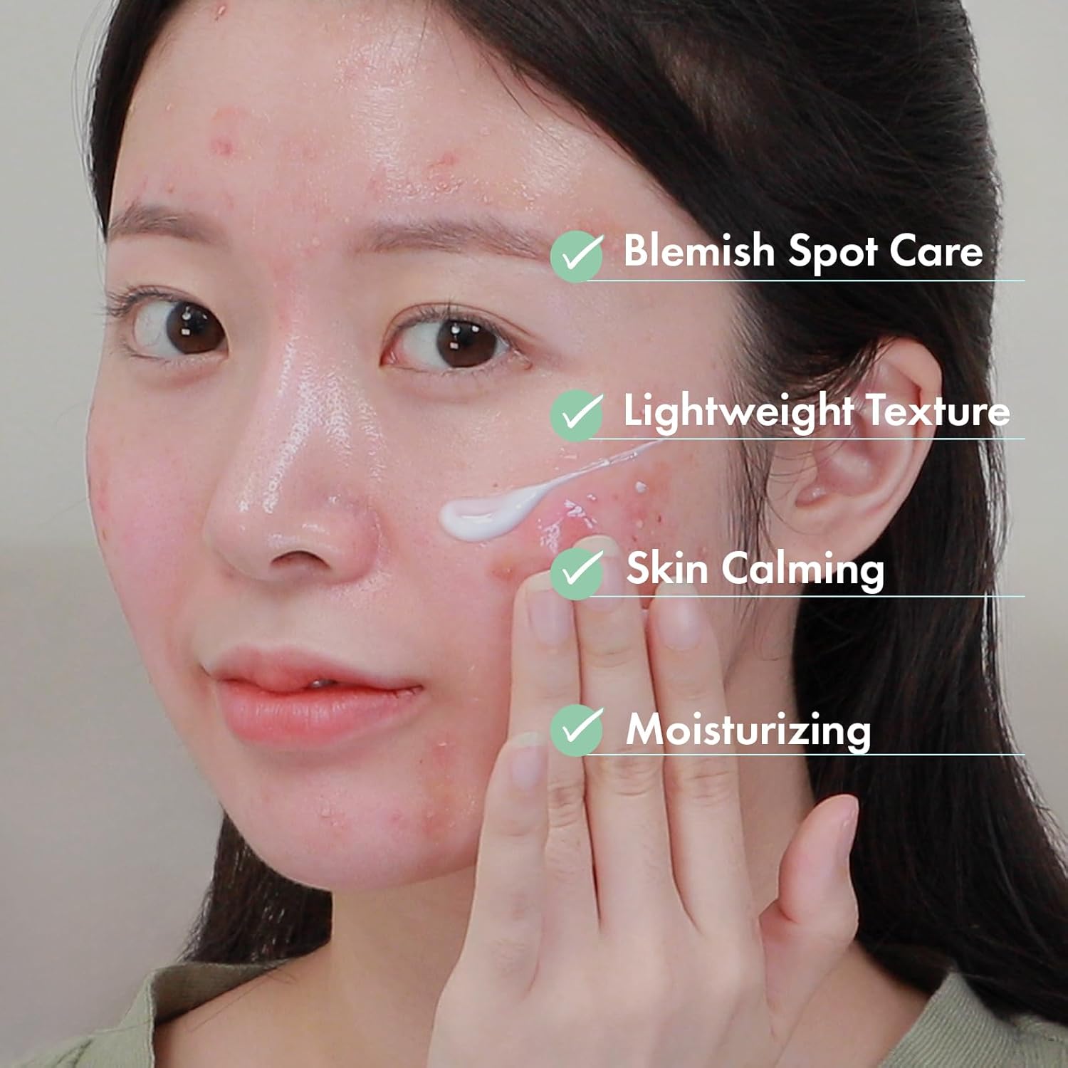 AC Kill Cream, BHA & Salicylic Acid Face Moisturizer, Niacinamide for Active Skin Repair, Tea Tree Oil for Soothing Sensitive Skin, acne spot treatment Korean Skincare, 30g, 1.05 oz. - Image 4
