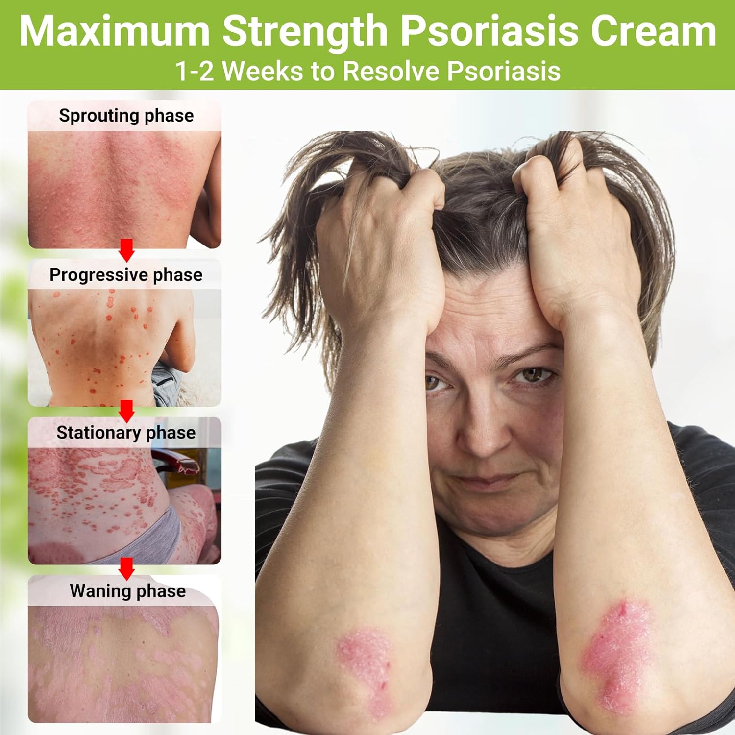 Maximum Strength Psoriasis Cream 3.53 oz Moisturizing Treatment for Itch Redness Flaking - Image 2