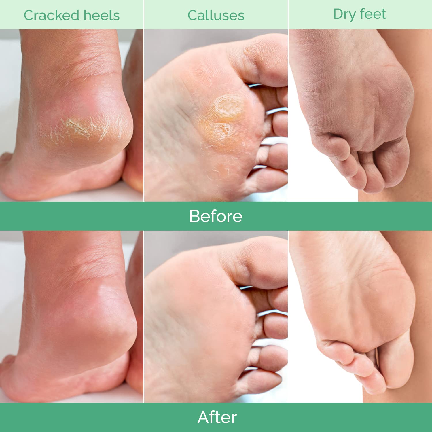 PLANTIFIQUE Peach Foot Peeling Mask 2 Pack for Soft Feet and Heel Repair - Image 3