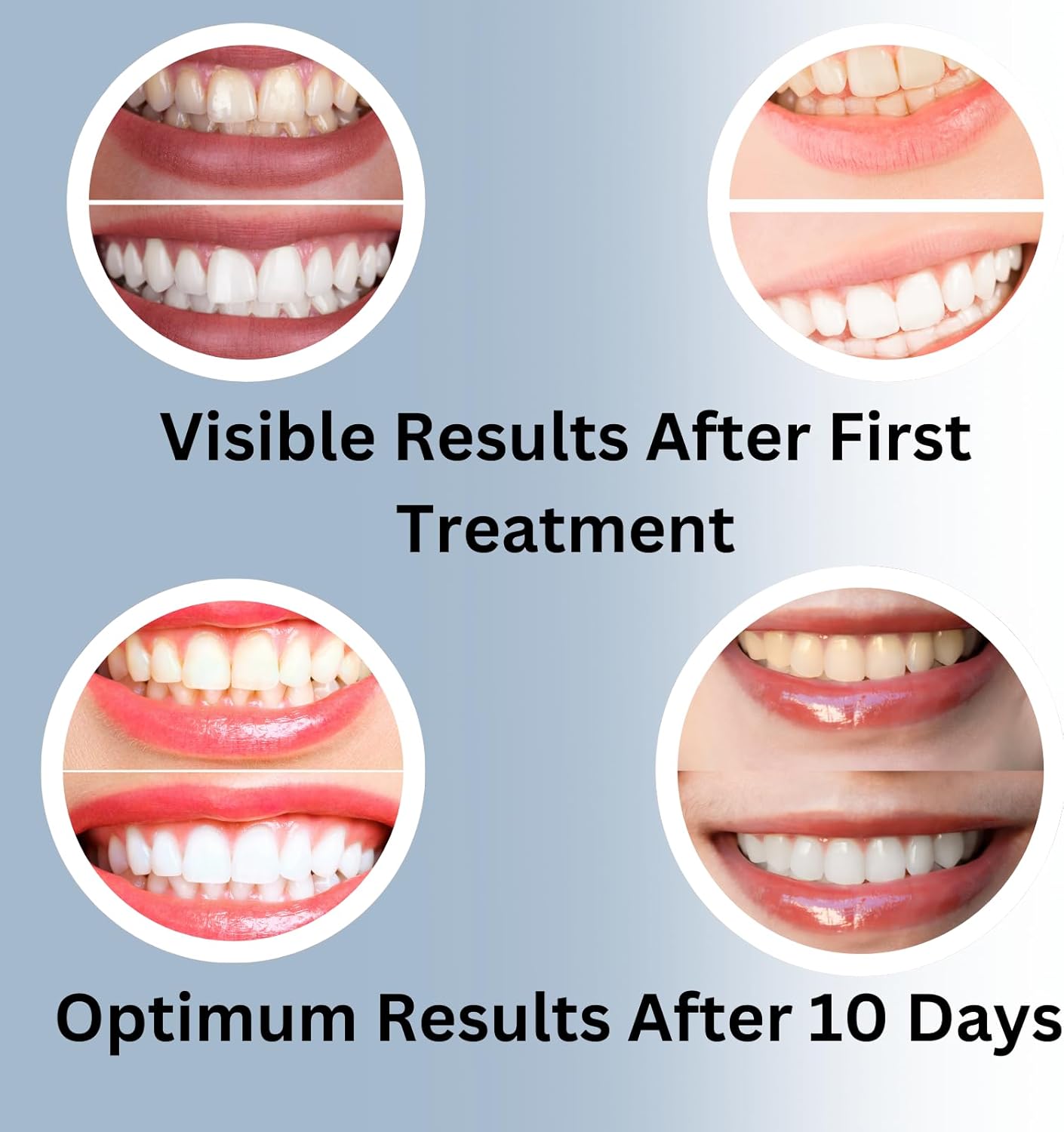 Teeth Whitening Gel for Trays 5 Pcs Fast Acting Teeth Whitening Gel Refill with Strongest 44% Carbamide Peroxide Gel, 2 Bleach Trays Included for Teeth Bleach, Enamel Safe, Gluten Free and Vegan - Image 7