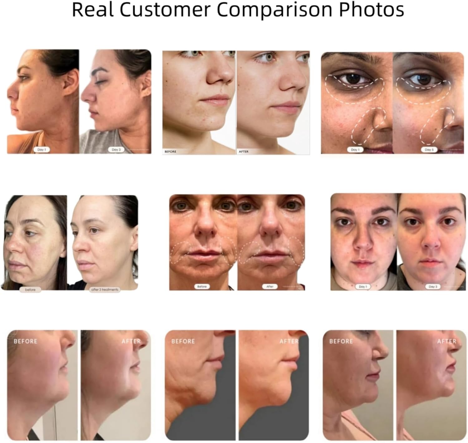 Double Effect 5-in-1Skin Firming Facial Device, Professional Home Beauty Device for Face and Body, 2025 New Upgrade 5 Energy Levels - Salon Results - Image 7