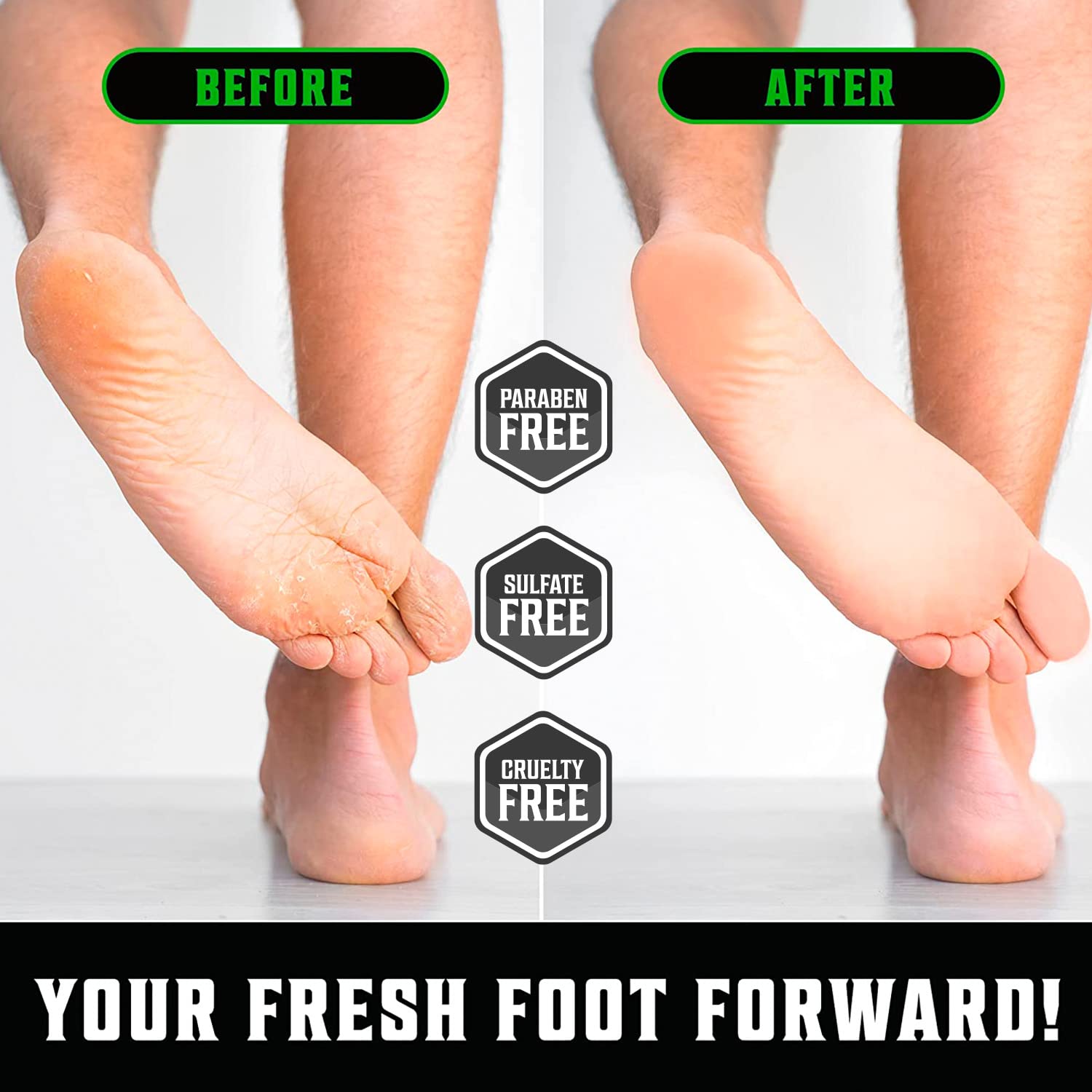 Viking Revolution Tea Tree Foot Cream Dry Cracked Heels 8oz Aloe Vera Mint Repair - Image 3