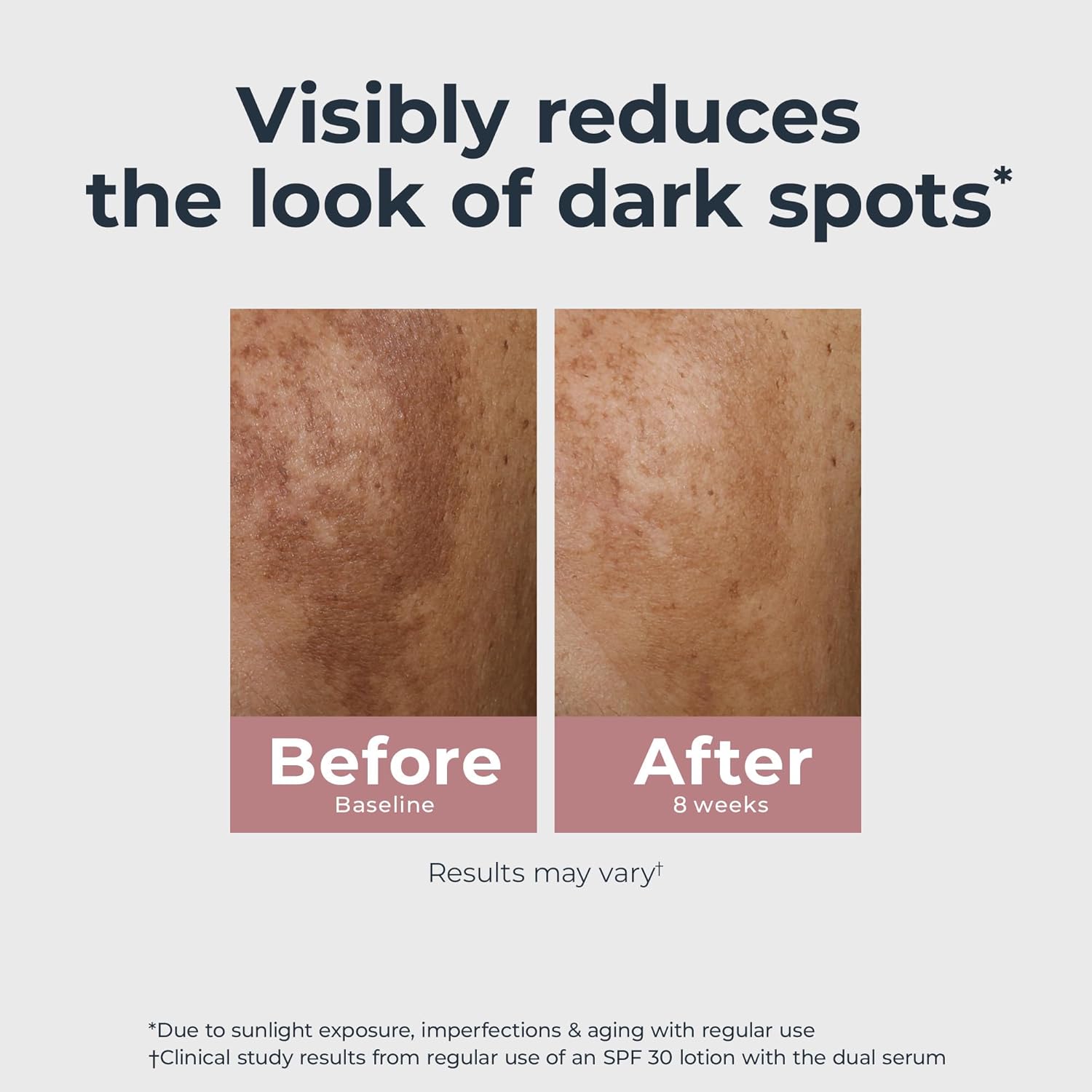 Eucerin Radiant Tone Dual Serum Dark Spot Corrector, Dark Spot Serum with Thiamidol and Hyaluronic Acid, Helps Visibly Reduce the Look of Persistent Dark Spots, 1 Fl Oz Bottle - Image 4