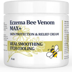 High Strength Bee Venom Cream, Dyshidrotic Eczema Ointment, Heat Rash, Itching, Eczema, Psoriasis, Leg, Stomach, Foot, Hand, Irritated Skin, All Age Care