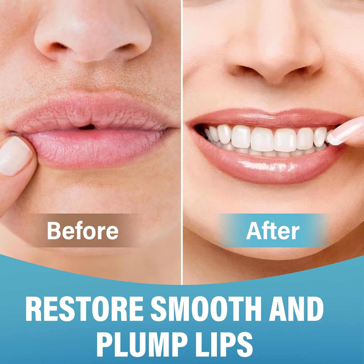 TOMENGBEIAABBCC 3 Pairs Anti-Wrinkle Lip Patches for Smoothing Smile Lines 15ml - Image 4