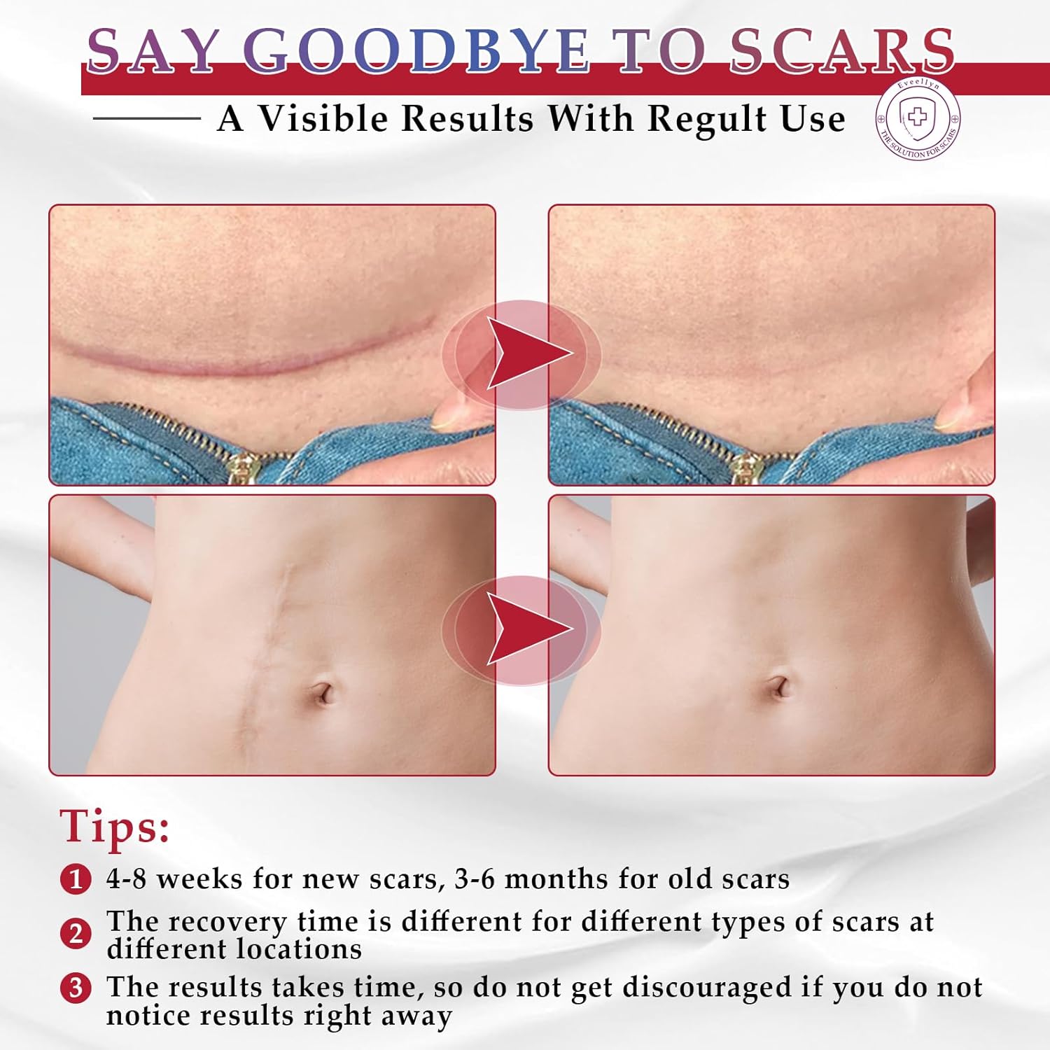 Advanced Scar Removal Cream Gel 1.7 oz for Surgical Stretch Marks Keloids C-Section Burns Acne - Image 4