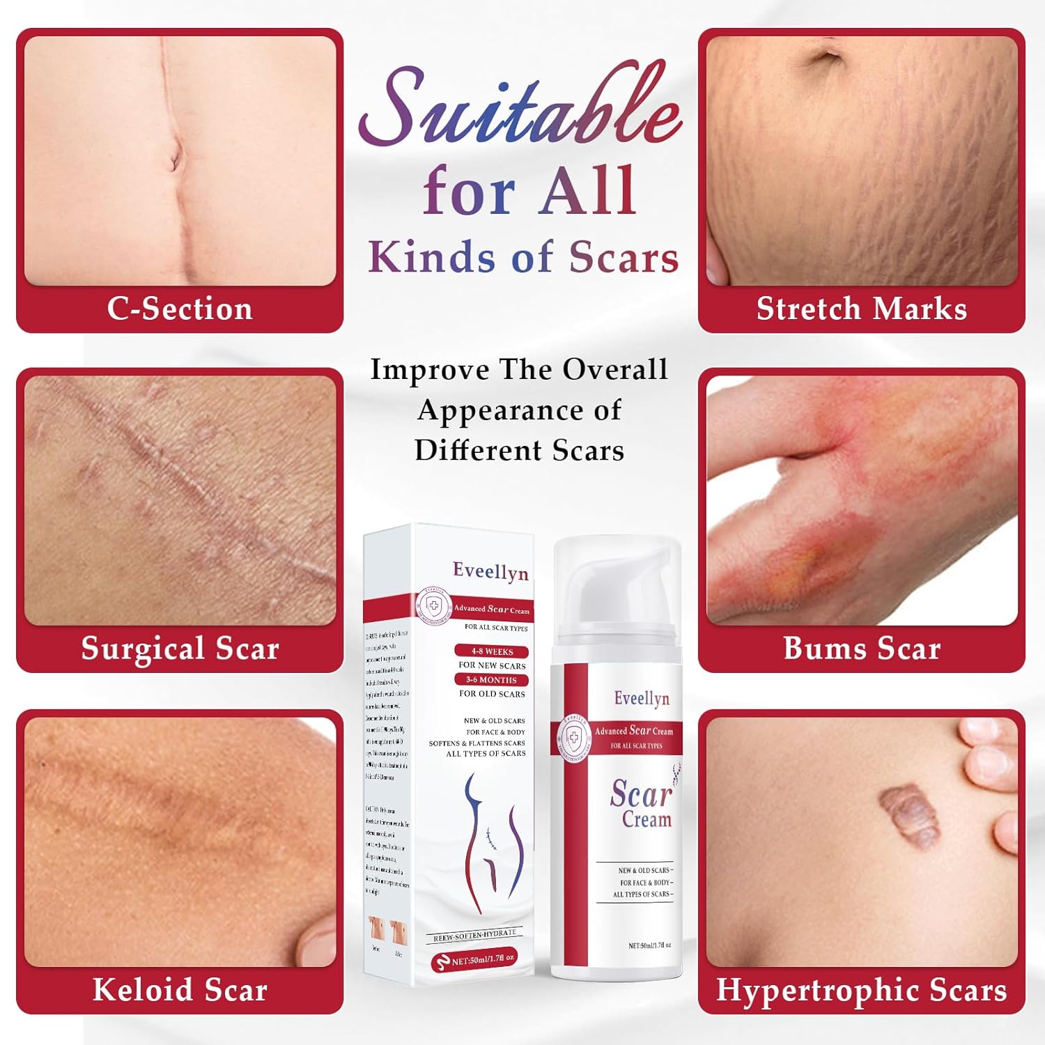 Advanced Scar Removal Cream Gel 1.7 oz for Surgical Stretch Marks Keloids C-Section Burns Acne - Image 2