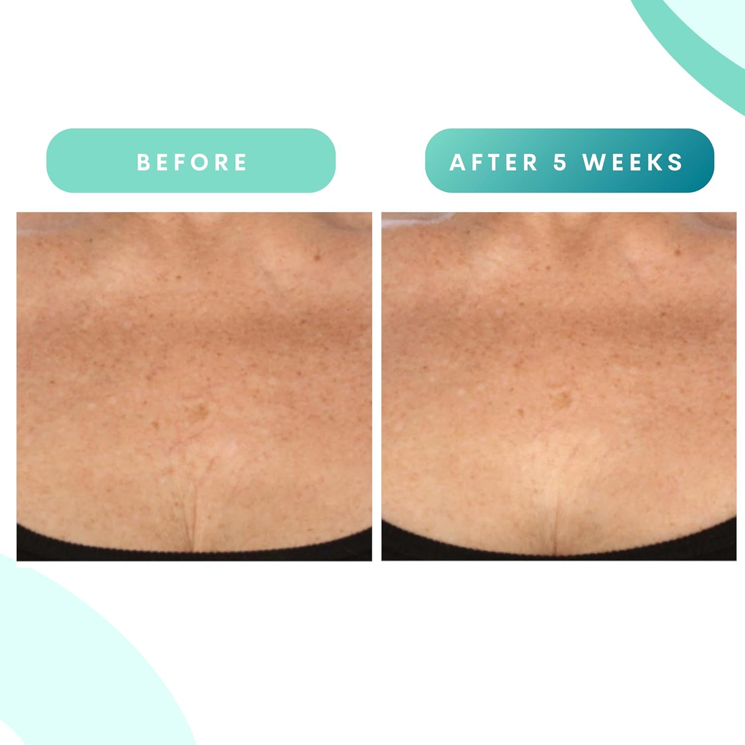 Serious Skincare - Glycolic Firming Retexturizing Body Cream - Moisturizing - Hydrating for Dry Skin - BODY FIT™ - For Crepey and Sagging Skin - Gentle Exfoliation for Smoother Skin - 8 Fl. Oz. - Image 5