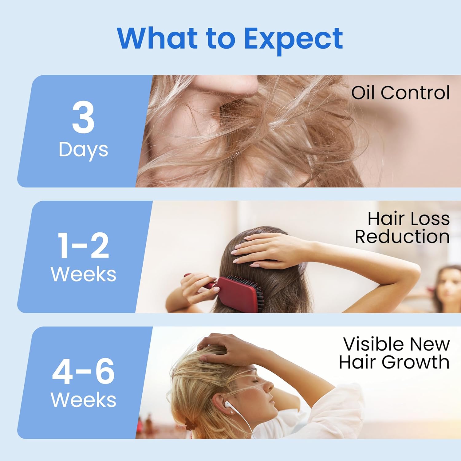0.5% KX-826 DHT Blocker Hair Thickening Growth Products,3 Days Oil Control 1-2 Weeks Hair Loss Reduction 4-6 Weeks New Hair Visible,Hair Growth Spray Regrowth Treatments Men&Women (blue) - Image 5