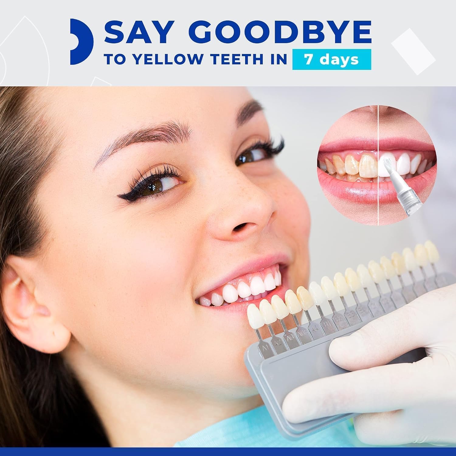 Gentle 35% Carbamide Peroxide Teeth Whitening Pen for Deep Stain Removal, No Sensitivity - Image 2