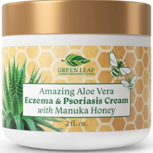 Manuka Honey Eczema Cream Moisturizing Lotion Treatment for Psoriasis Relief - Itchy, Dry Skin Rash Ointment - Soothing Moisturizer for Baby, Kids, Adults - High Strength Body & Face Cream 2oz
