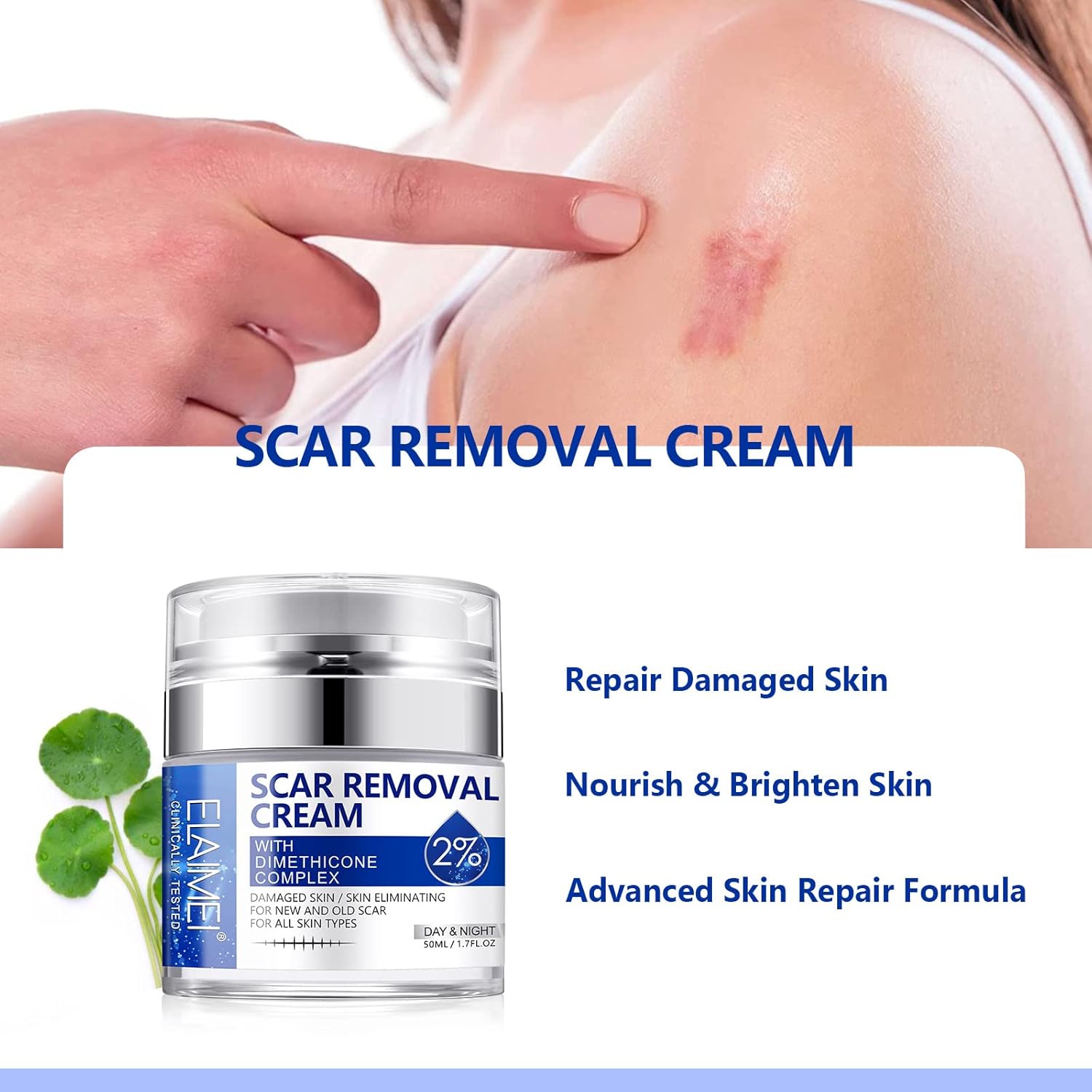 Scar Cream, Scar Removal Cream - Advanced Scar Cream for Surgical Scars, Acne Scars, C-Section, Burns, Stretch Marks -Effective for Old and New Scars Gel Acne Scar Treatment - Image 3