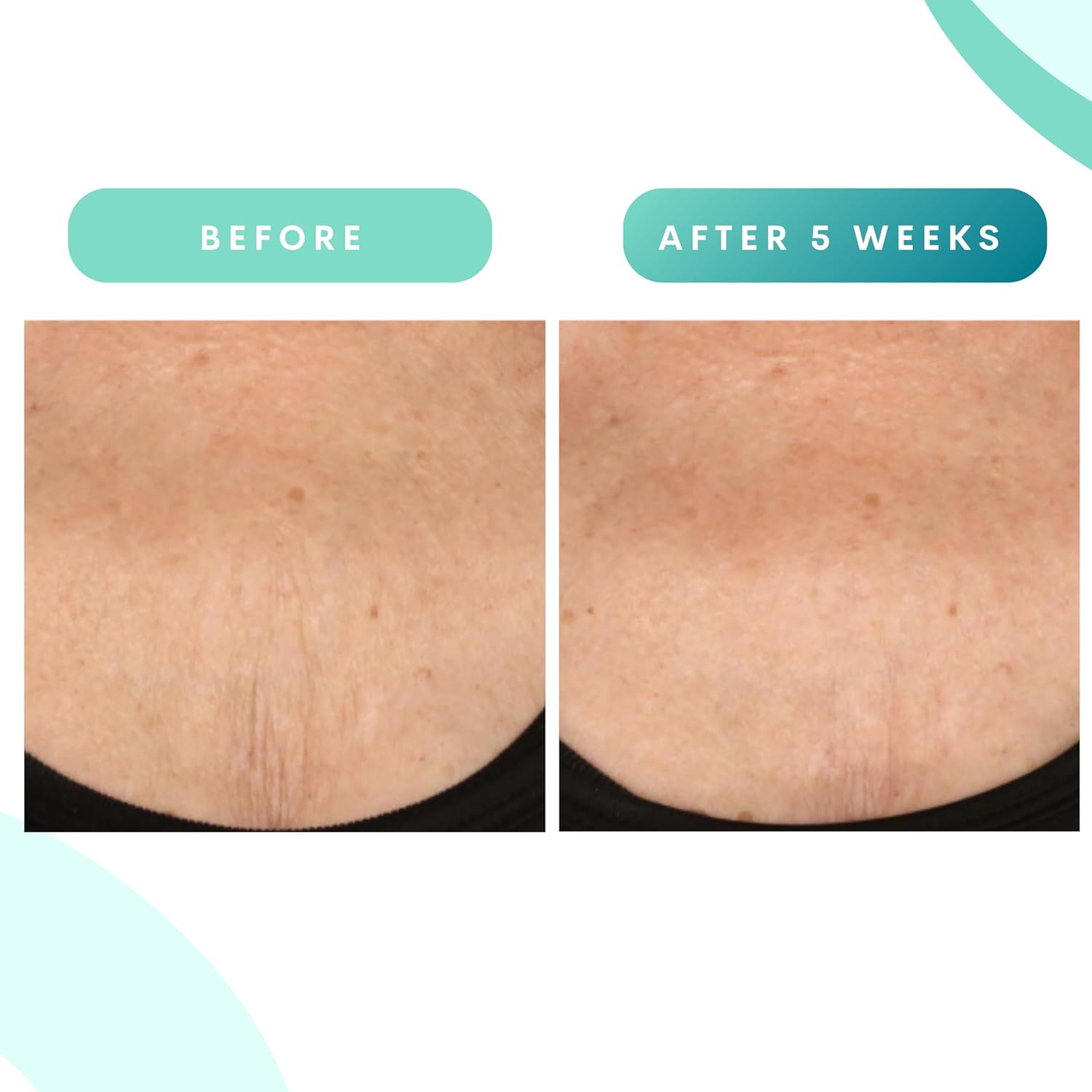 Serious Skincare - Glycolic Firming Retexturizing Body Cream - Moisturizing - Hydrating for Dry Skin - BODY FIT™ - For Crepey and Sagging Skin - Gentle Exfoliation for Smoother Skin - 8 Fl. Oz. - Image 7