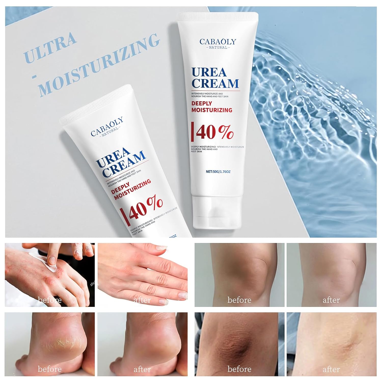 Urea Cream 40% is suitable for the repair and care of dry and cracked feet, heels, knees, elbows and hands. Portable hand cream with moisturizing properties - Image 2