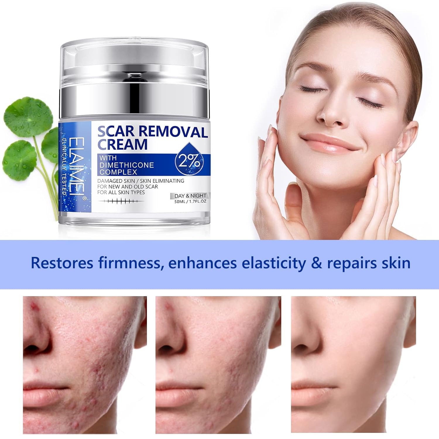 Scar Cream, Scar Removal Cream - Advanced Scar Cream for Surgical Scars, Acne Scars, C-Section, Burns, Stretch Marks -Effective for Old and New Scars Gel Acne Scar Treatment - Image 7