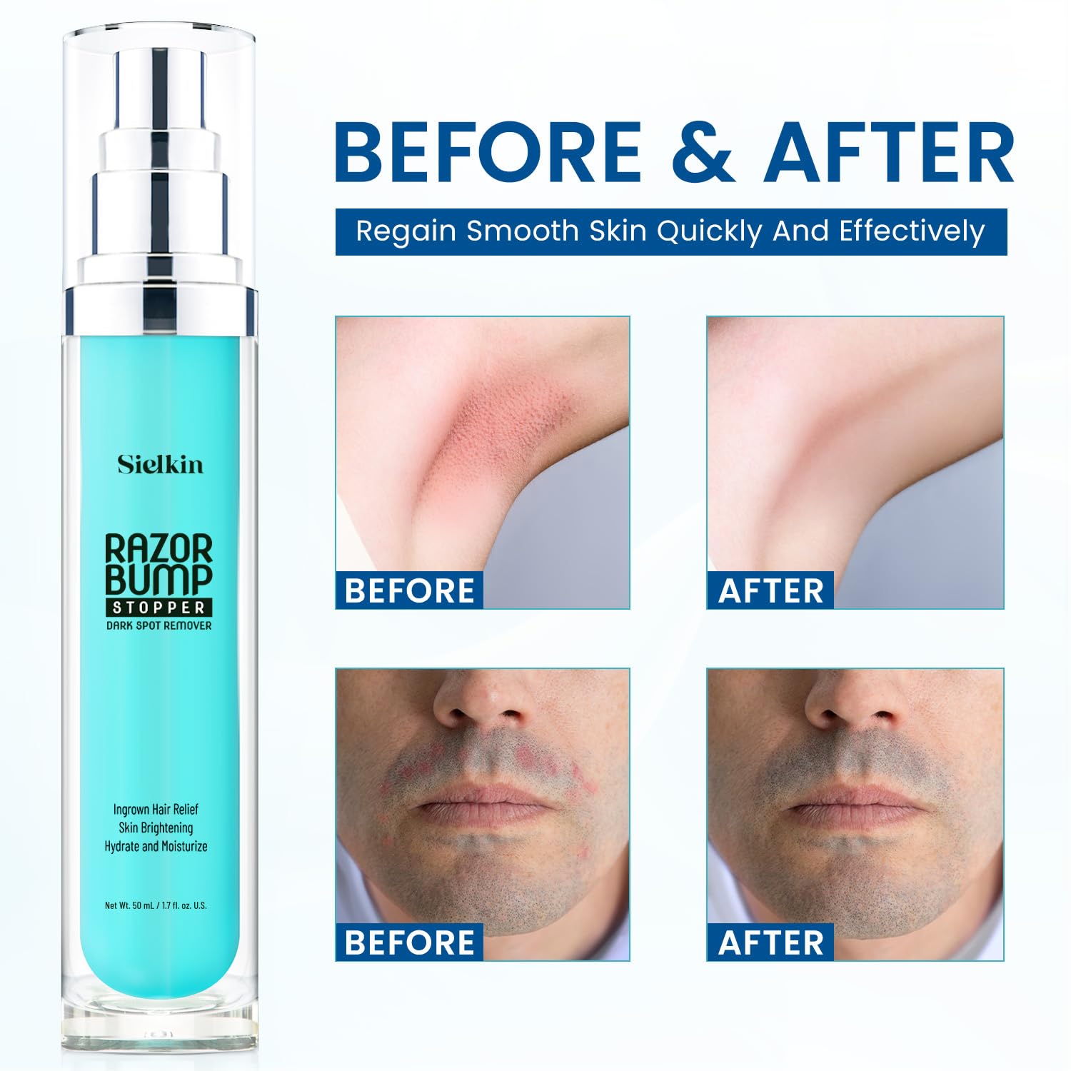 Sensitive Skin Razor Bump Treatment Lotion 1.3 Fl Oz Unisex Formula - Image 2