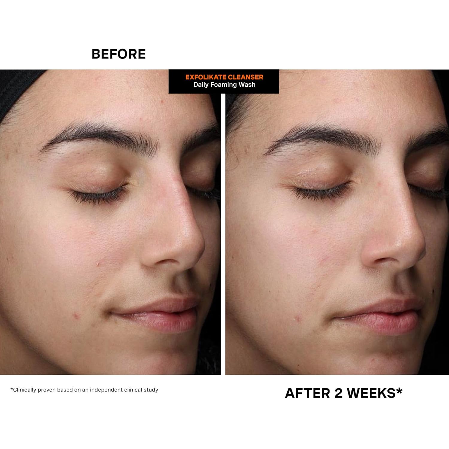 Kate Somerville ExfoliKate Cleanser – Daily Exfoliating Foaming Face Wash – Clinically Formulated Glycolic Acid and Lactic Acid Gentle Facial Scrub - Image 9