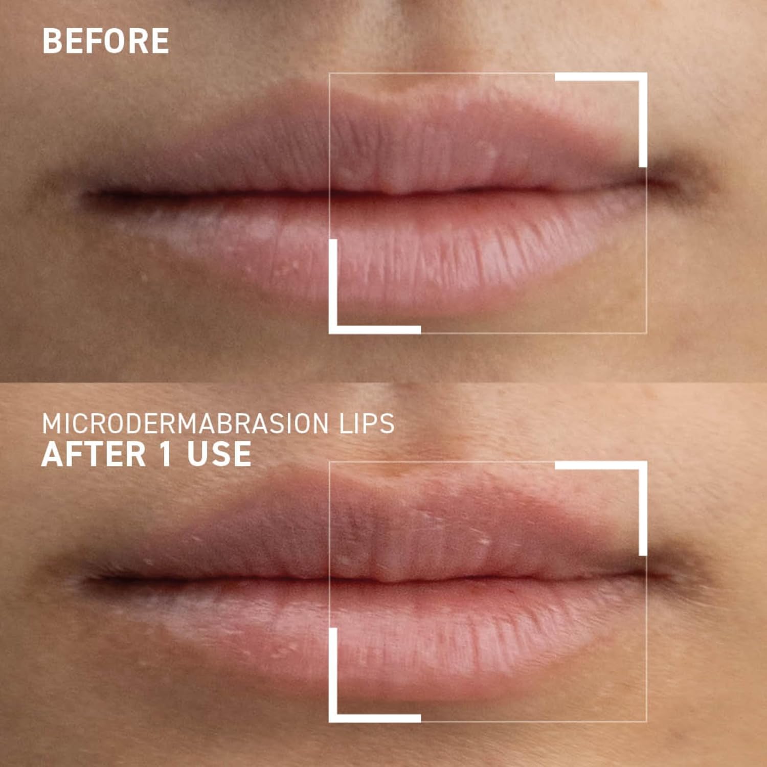 Dr. Brandt Microdermabrasion Lip Exfoliator 0.35 oz for Smooth, Renewed Lips - Image 5