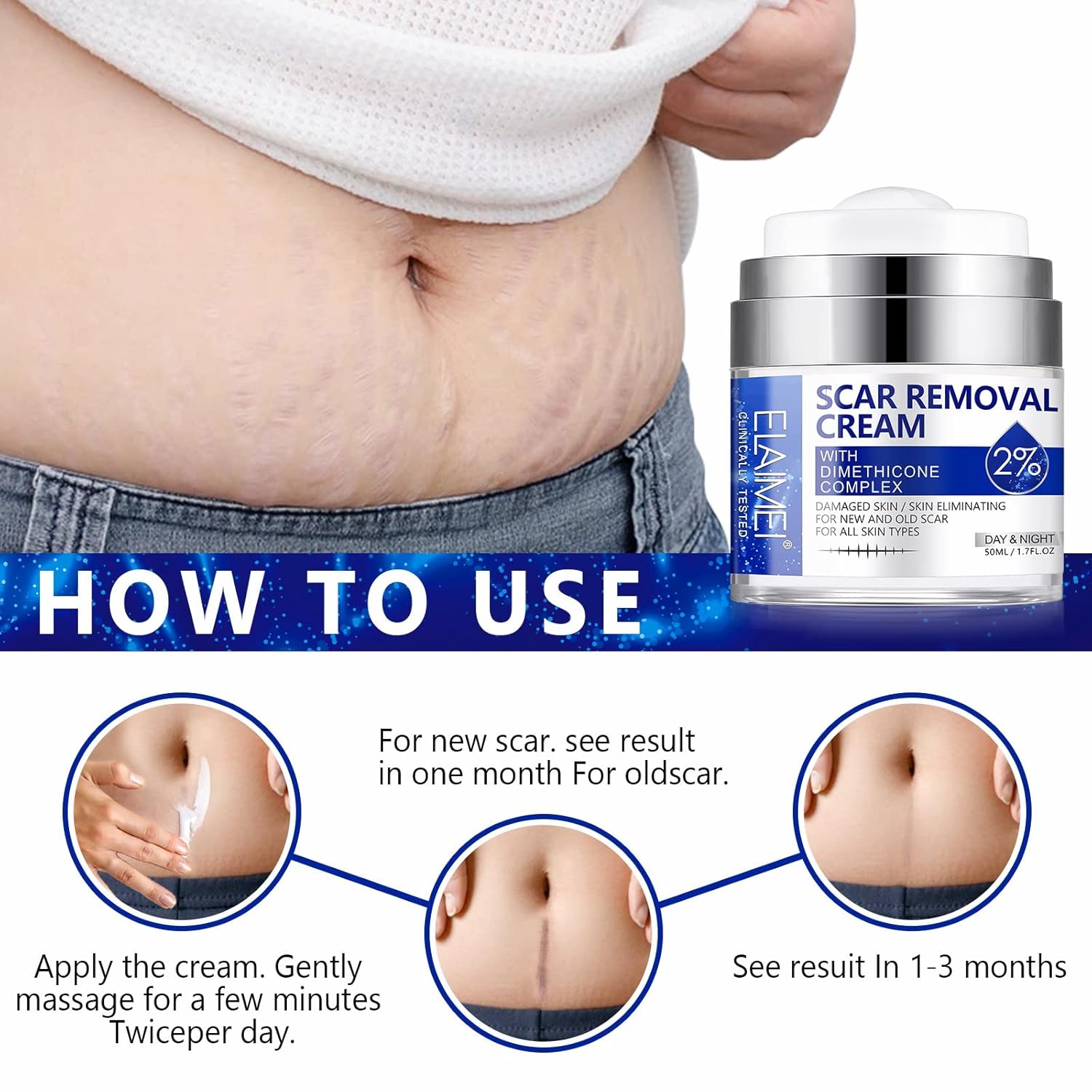 Scar Cream, Scar Removal Cream - Advanced Scar Cream for Surgical Scars, Acne Scars, C-Section, Burns, Stretch Marks -Effective for Old and New Scars Gel Acne Scar Treatment - Image 4