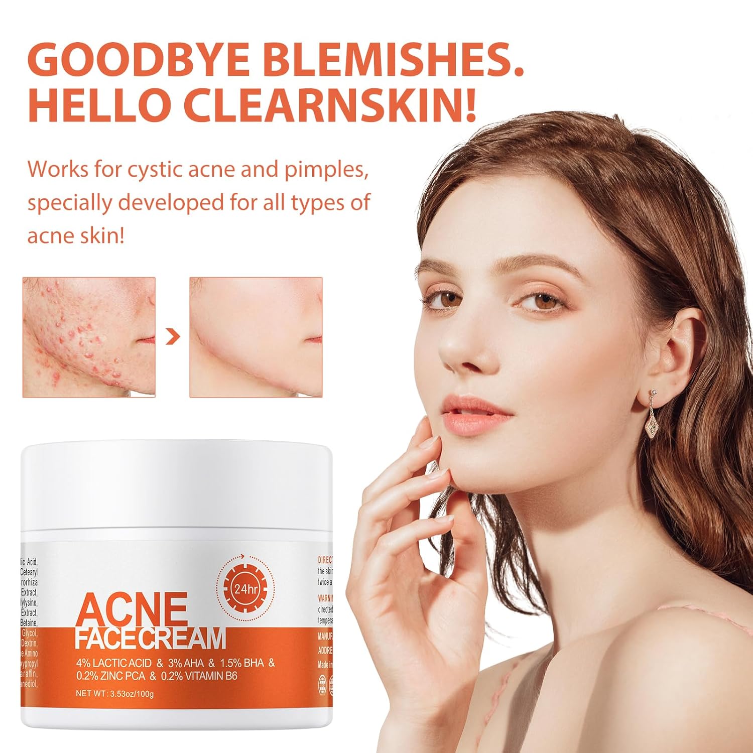 Acne Cream, Salicylic Acid Cystic Acne Treatment For Face, Back Butt Acne Treatments Creams, Acne Spot Treatment for Face Body, Acne Clearing Pimple Cream for Teens & Adults, Acne Moisturizer - Image 3