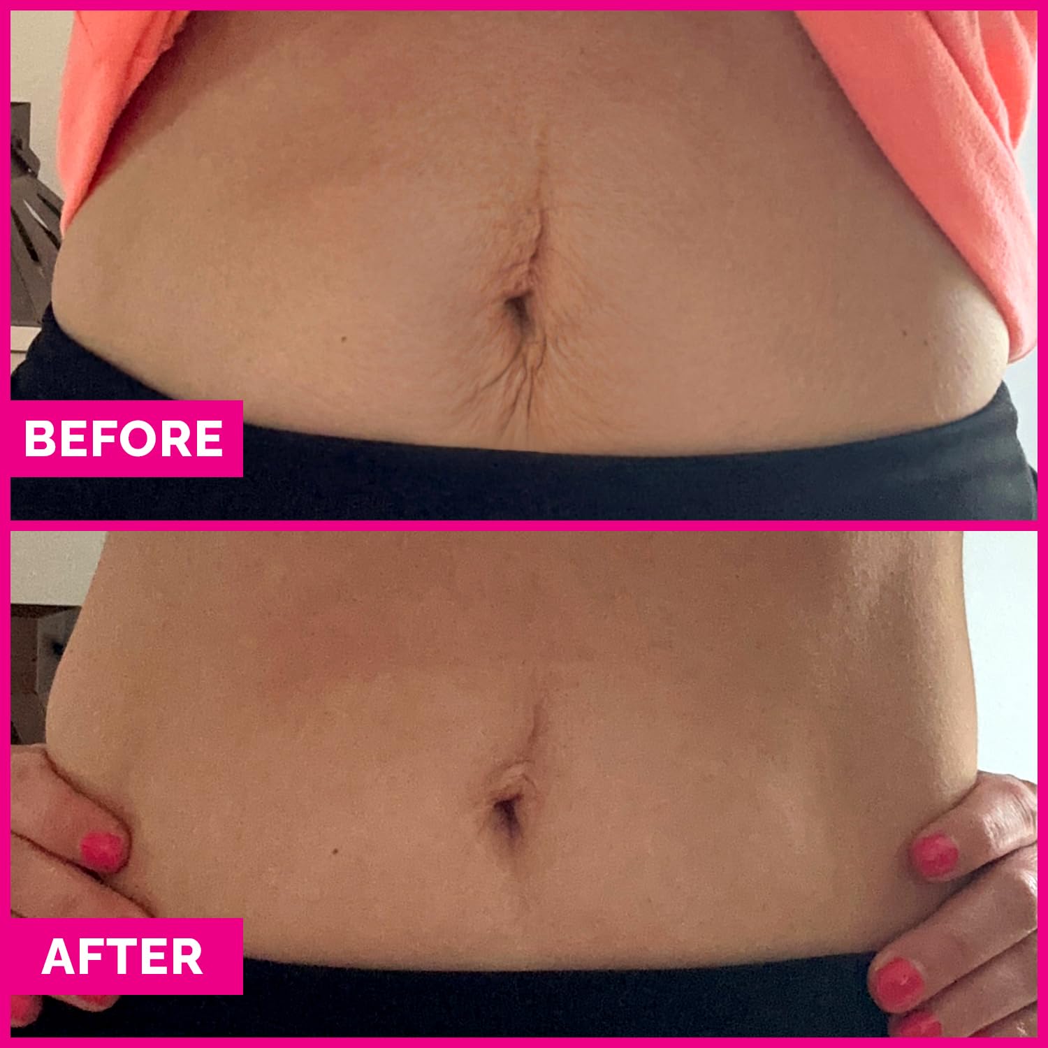Tummy Sleek Stomach Firming Cream - Skin Tightening Serum for Belly - Helps to Improve the Appearance of Loose Skin and Cellulite on the Abdomen & Waist - Toning Body Lotion with Caffeine - Image 6