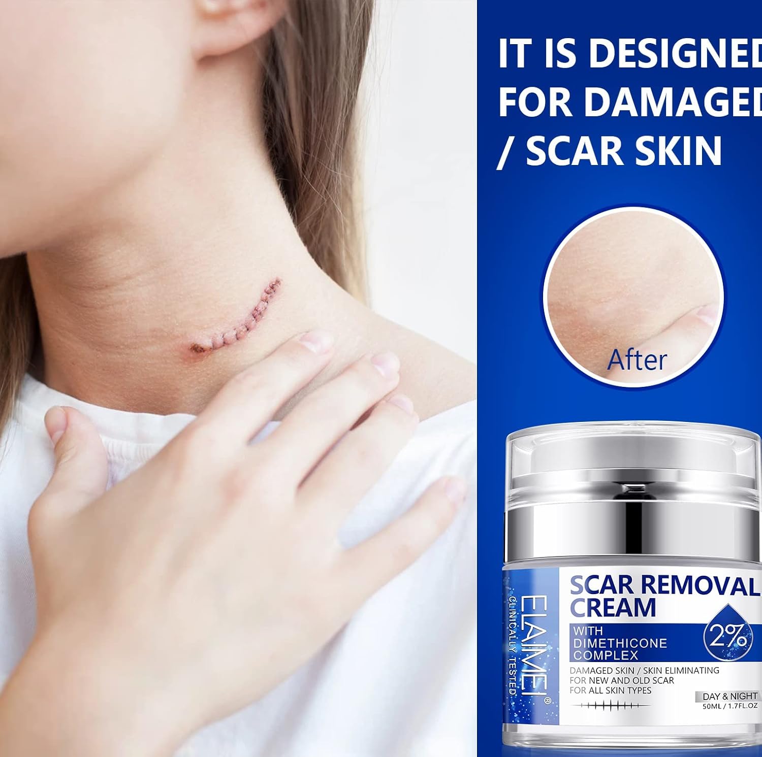 Scar Cream, Scar Removal Cream - Advanced Scar Cream for Surgical Scars, Acne Scars, C-Section, Burns, Stretch Marks -Effective for Old and New Scars Gel Acne Scar Treatment - Image 6