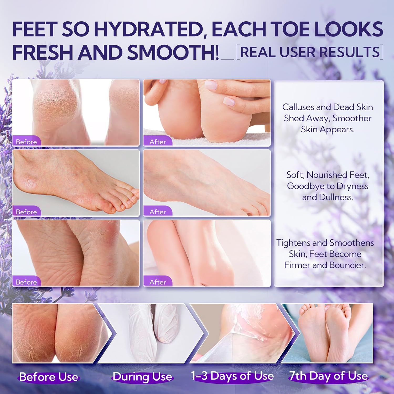 LANBENA Lavender Foot Peel Mask for Soft Feet, Removes Dead Skin and Calluses, 2 Pairs - Image 7