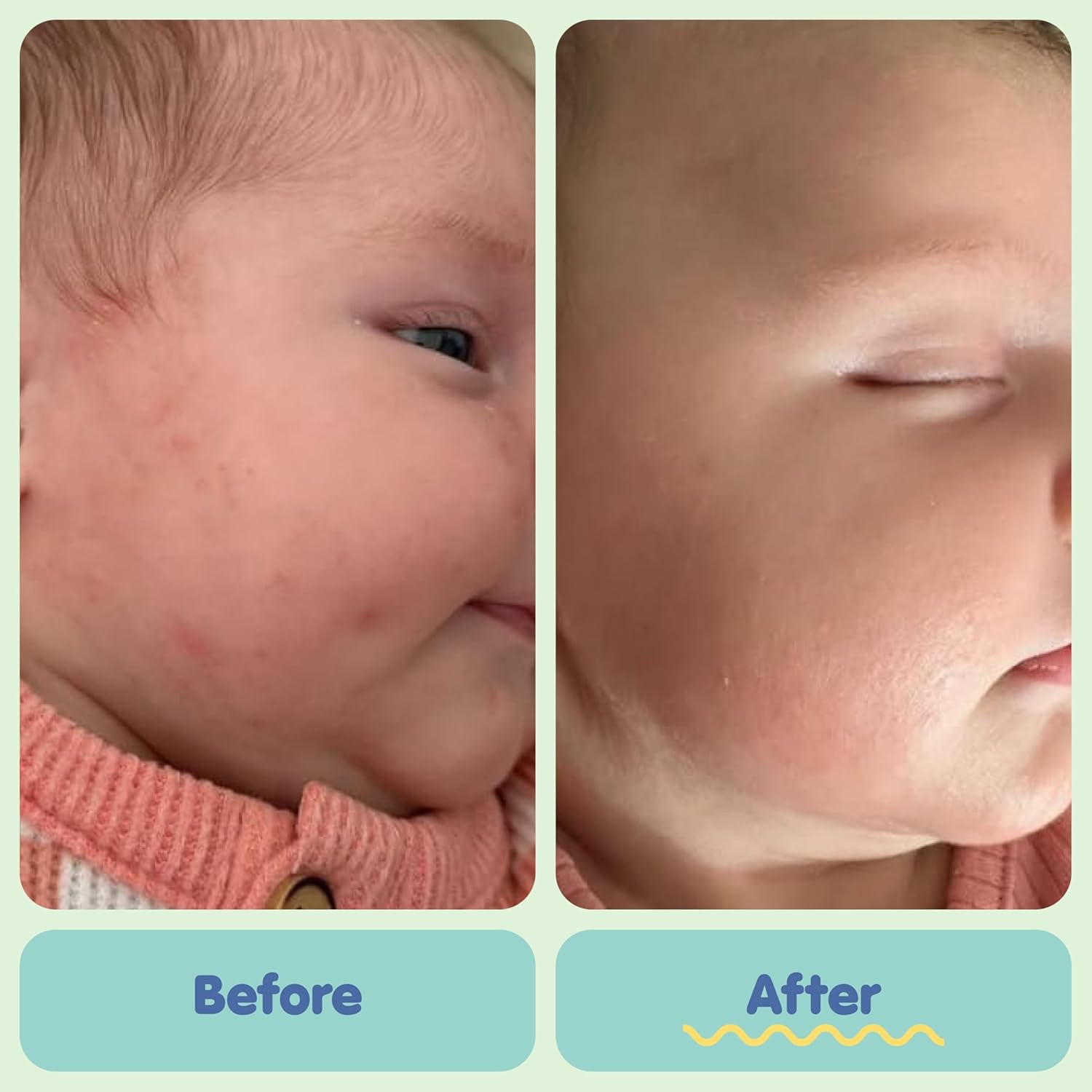 TUBBY TODD All Over Ointment - Baby Eczema Cream - Everyday Multi-Purpose Baby Skin Relief Cream - Sensitive Skin, Dry Skin & Irritation - Steroid & Gluten Free - Fragrance Free, 2 Pack 3.5oz & 8oz - Image 5
