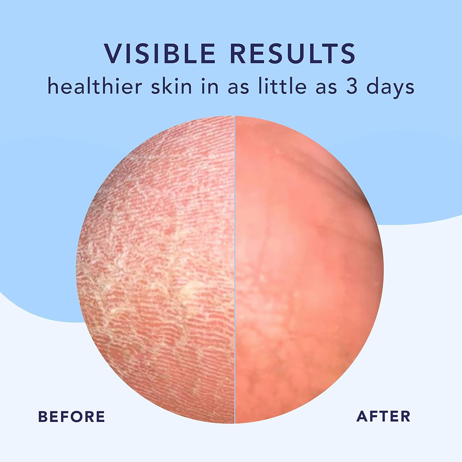 Barefoot Scientist High Dive Intensive Hydration Foot Therapy Cream, Specialized Moisture for Dry Feet and Cracked Heels - Image 3